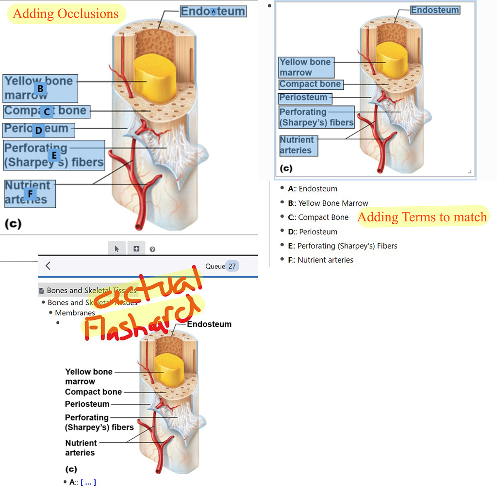 occlusion-flashcards-remnote